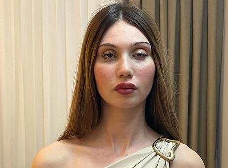 Düğün Öncesi Botoks Kabusu: Göz Kapağı Düşen İdil Keten'in Yaşadığı Şok Olay