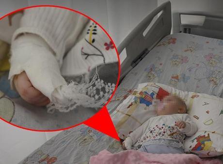 Hatay'da Bebeğin Parmağa Yapılan Müdahale, Şok Edici Bir Kaza Sonucu Sakıncalı Hale Geldi