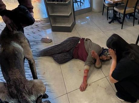Afyonkarahisar'da Dinlenme Tesisinde Köpek Saldırısı: Kadının Kolunu Kopardı
