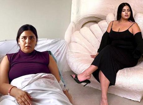 Lazer Epilasyon Faciası: 20 Gün Hastanede Kaldı, Şikayetçi Oldu