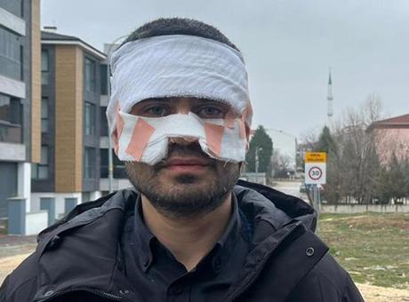 Lisede Sıcak Çayla Yaşanan Skandal: Fizik Öğretmeni Yanık Tedavisi Görüyor