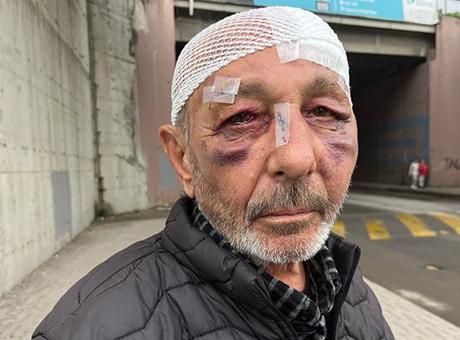 İzmit'te Yaşanan Saldırı Olayında Bir Kişi Tutuklandı