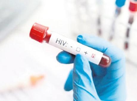 HIV Hastalığını Gizleyen Kocaya 10 Ay Hapis Cezası