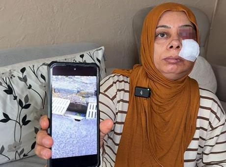 Elektrikli Bisiklet Kazası: Kırık Rögar Kapağı Hayatı Tehdit Ediyor