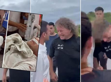 Arjantin'de Milletvekiline Şok Saldırı: Burnu Kırıldı ve Hastaneye Kaldırıldı