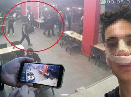 Konyaaltı'nda Akran Zorbalığı: Genç Kızın Burnu Kırıldı