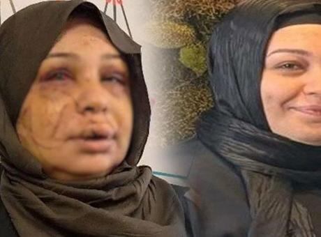 Ankara'da Yaşanan Şiddet Olayında Eşine 60 Dikiş Atıldı: 'Büyük Bir Aile Katliamını Önledim'