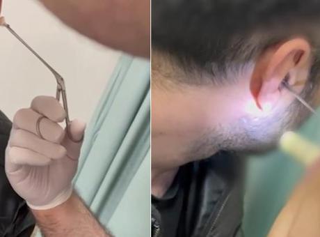 Motosikletli Polisler, Şüpheliyi Durdurdu; Kulak Kanalında Uyuşturucu Bulundu