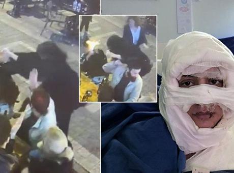 Kadıköy'de genç kadını kolonya ile ateşe veren Sibel Arya Geriş ifade verdi