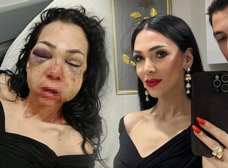 Kocaeli'de Bayram Günü Dehşet Anları: Anne ve Oğlu Darp Edildi