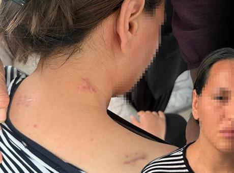 Korkunç İhanet: Eşinin Bıçaklı Saldırısından Sonra Yaşadığı Korku Dolu Günler