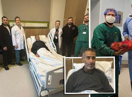 Gaziantep'te 8 Kiloluk Böbrek Başarıyla Alındı: Mustafa Doğan Ameliyat Sonrası Rahatladı