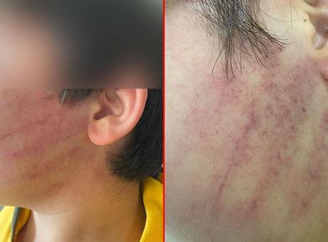 Okulda Dehşet Anları: Aile İki Çocuğu Hastanelik Etti