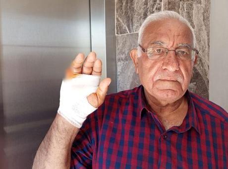 Asansörde Korkunç Saldırı: Komşunun A.E. Parmak Kopardı