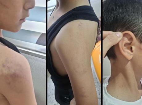 Manisa'da Aile İçi Şiddet: Çocuk Koruma Altına Alındı