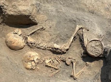 Özbekistan'da 4 Bin Yıllık Çocuğa Uygulanan Cerrahi Müdahale: Tarihin En Eski Kanıtlarından Biri