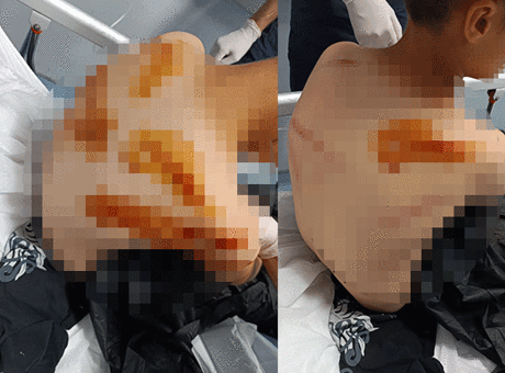 Şanlıurfa'da Akıl Almaz Olay: 11 Yaşındaki Çocuğa Komşusundan Saldırı