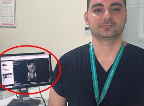 İstanbul'da Zayıflama Arayışında Korkunç Kaza: Diş Fırçası Yutan Genç Kadın Hastaneye Kaldırıldı