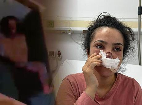 Eşi tarafından burnu ısırılıp koparılan İmran dehşeti anlattı: Acıyla balkondan atlamayı düşündüm