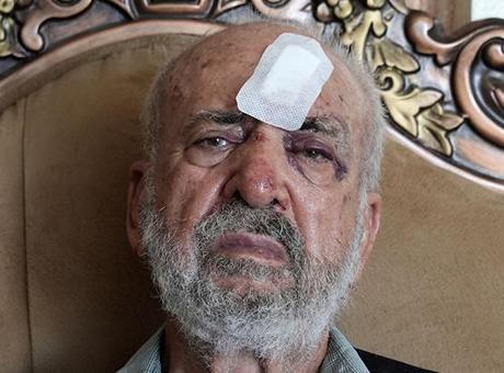 İsrail askerlerinden 80 yaşındaki Filistinliyi darbederek yaraladı