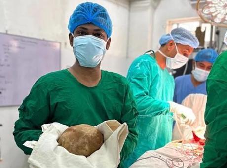 Sri Lanka'da akılalmaz ameliyat: Hastadan 3.1 kiloluk mesane taşı çıkarıldı