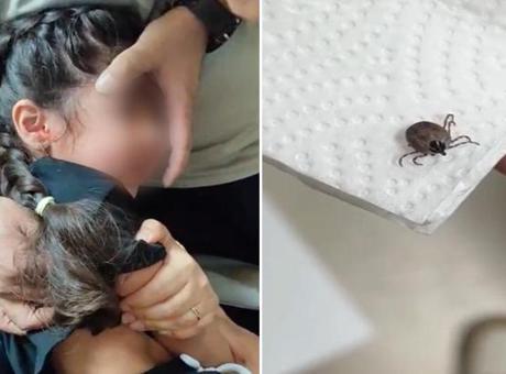 Bir aydır kulak ağrısı çekiyordu! Kulağında canlı kene bulundu