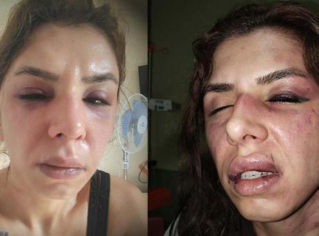 İstanbul’da dehşet! Eşini saatlerce darbedip bıçakla tehdit ettiği iddiası: 'Şehadet getir'